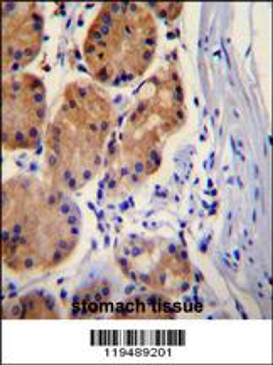 CTNB1 Antibody immunohistochemistry analysis in formalin fixed and paraffin embedded human stomach tissue followed by peroxidase conjugation of the secondary antibody and DAB staining.