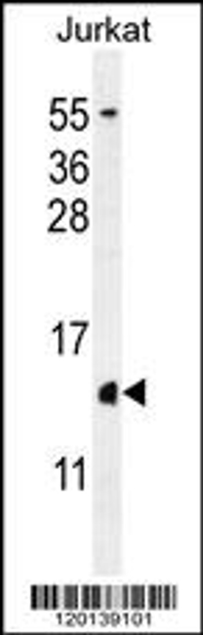 Western blot analysis in Jurkat cell line lysates (35ug/lane) .