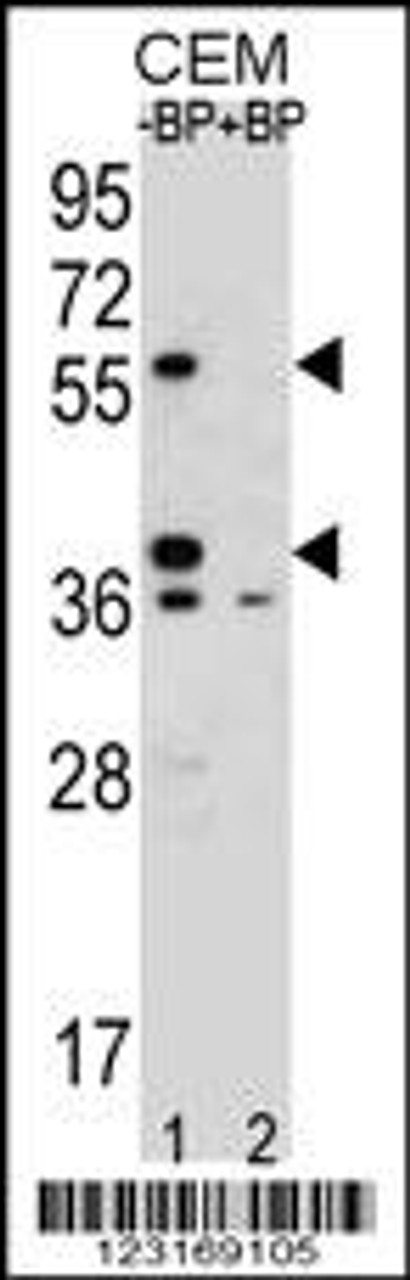 Western blot analysis of MNDA Antibody Pab pre-incubated without (lane 1) and with (lane 2) blocking peptide in CEM cell line lysate