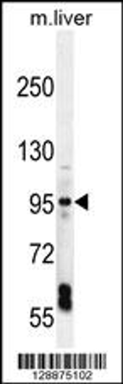 Western blot analysis in mouse liver tissue lysates (35ug/lane) .