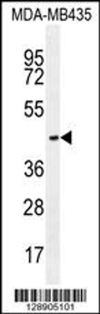 Western blot analysis in MDA-MB435 cell line lysates (35ug/lane) .