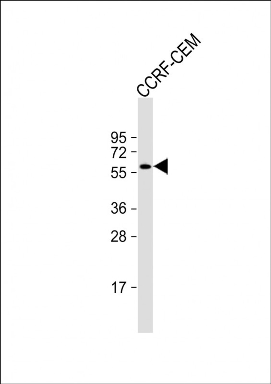 Western Blot at 1:500 dilution + CCRF-CEM whole cell lysate Lysates/proteins at 20 ug per lane.