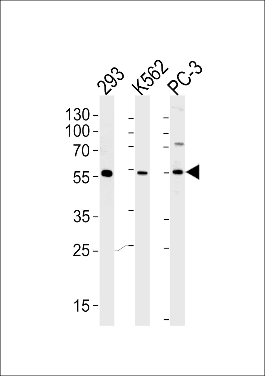 Western blot analysis of lysates from 293, K562, PC-3 cell line (from left to right) , using PIP5KL1 Antibody . at 1:1000 at each lane.