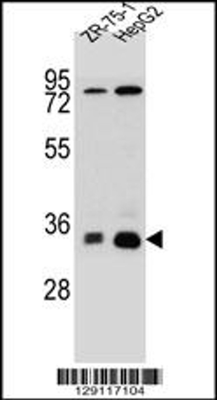 Western blot analysis in HepG2, ZR-75-1 cell line lysates (35ug/lane) .