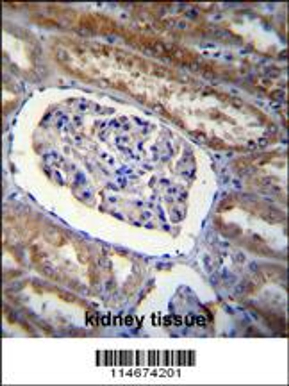ARL8 Antibody immunohistochemistry analysis in formalin fixed and paraffin embedded human kidney tissue followed by peroxidase conjugation of the secondary antibody and DAB staining.
