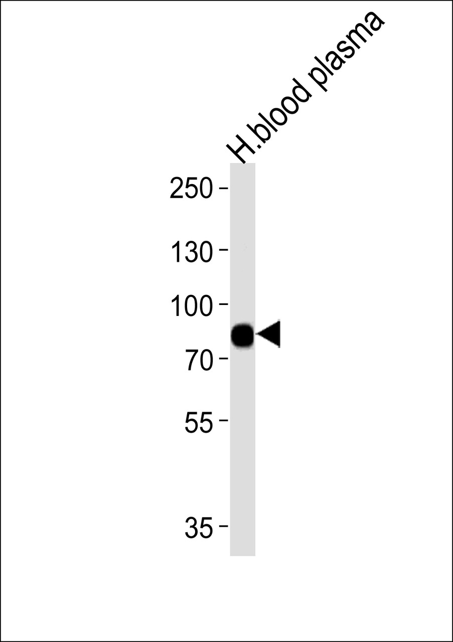 Western blot analysis of lysates from human blood plasma tissue (from left to right) , using LRRC45 Antibody .AP11368b was diluted at 1:1000 at each lane.