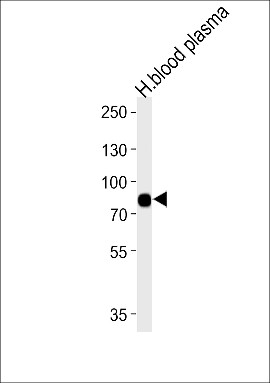 Western blot analysis of lysates from human blood plasma tissue (from left to right) , using LRRC45 Antibody .AP11368b was diluted at 1:1000 at each lane.