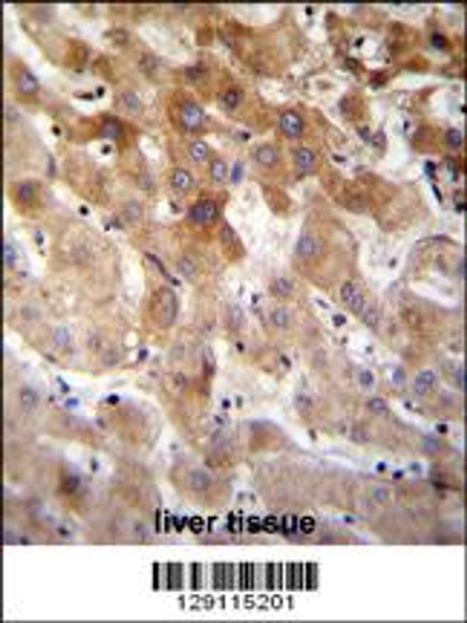 MBTD1 Antibody immunohistochemistry analysis in formalin fixed and paraffin embedded human liver tissue followed by peroxidase conjugation of the secondary antibody and DAB staining.