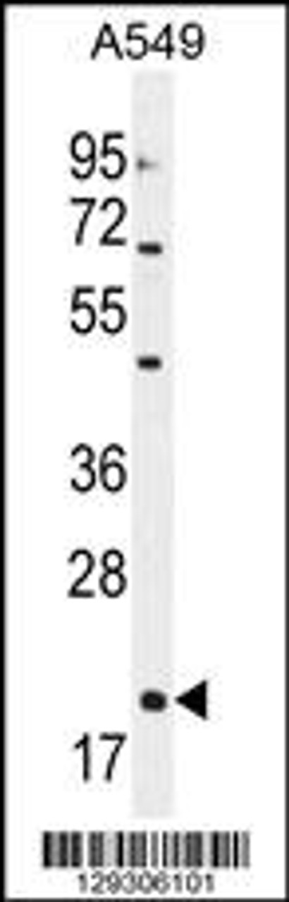 Western blot analysis in A549 cell line lysates (35ug/lane) .