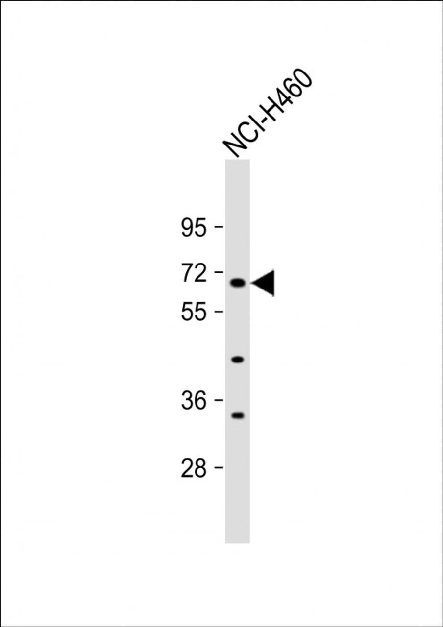 Western Blot at 1:1000 dilution + NCI-H460 whole cell lysate Lysates/proteins at 20 ug per lane.