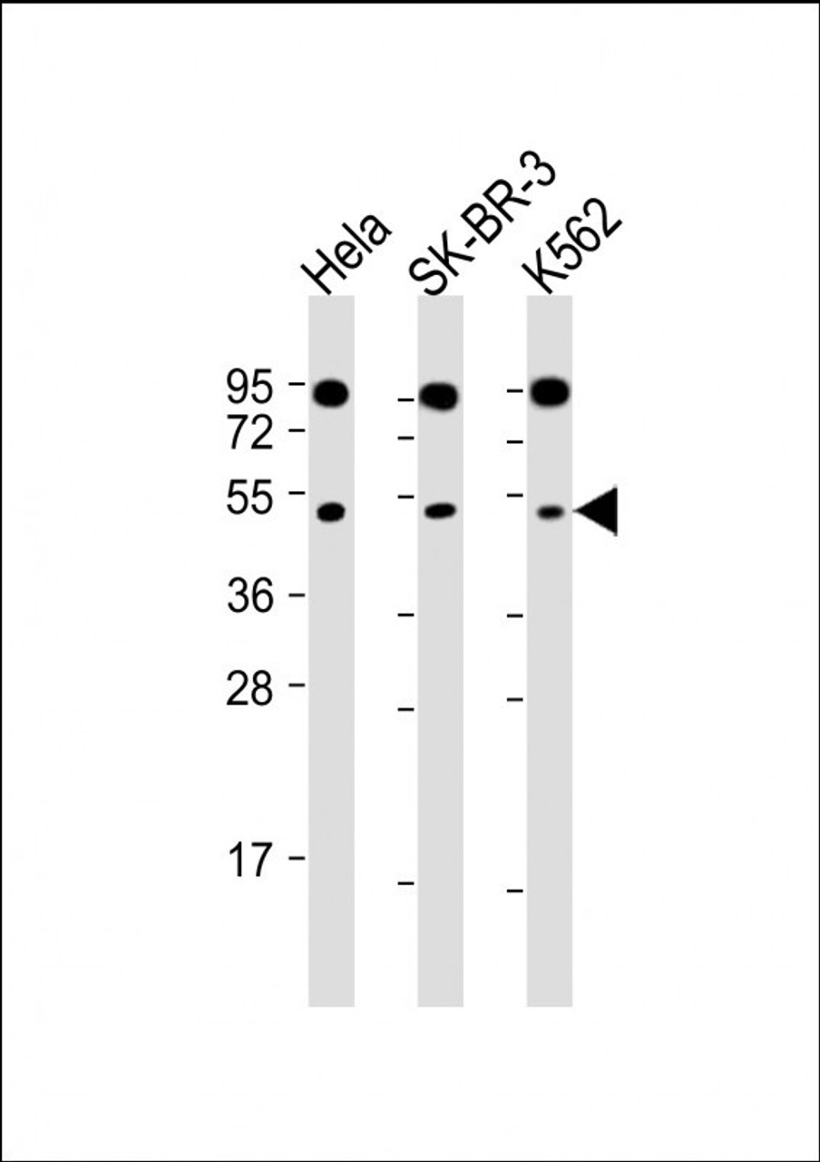 Western Blot at 1:2000 dilution Lane 1: Hela whole cell lysate Lane 2: SK-BR-3 whole cell lysate Lane 3: K562 whole cell lysate Lysates/proteins at 20 ug per lane.