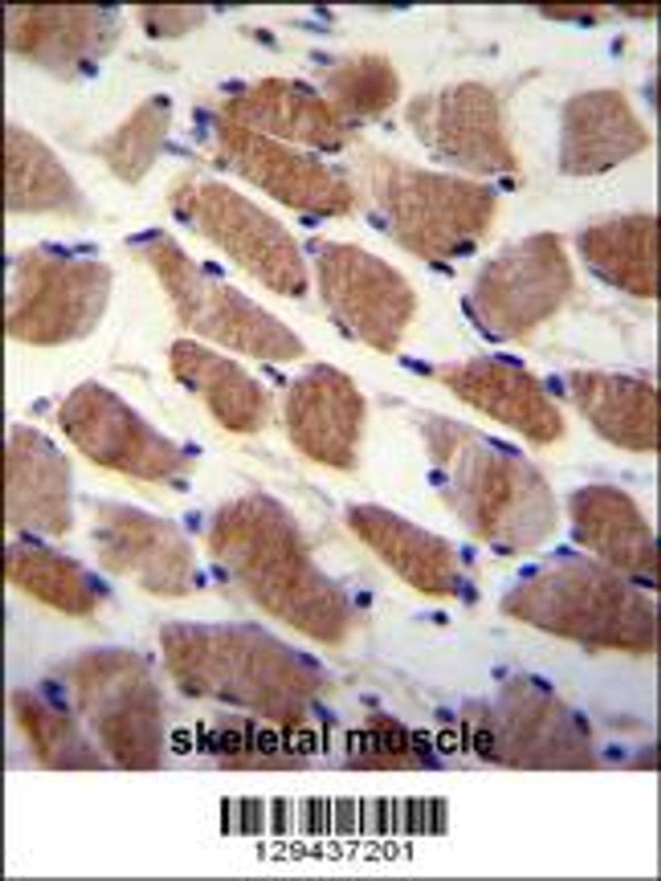 SAMD7 Antibody immunohistochemistry analysis in formalin fixed and paraffin embedded human skeletal muscle followed by peroxidase conjugation of the secondary antibody and DAB staining.