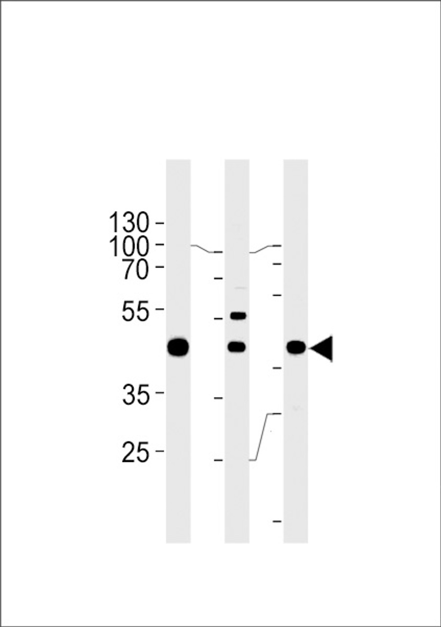 Western blot analysis in A549, K562, MCF-7 cell line lysates (35ug/lane) .This demonstrates the GTF2H2C antibody detected the GTF2H2C protein (arrow) .