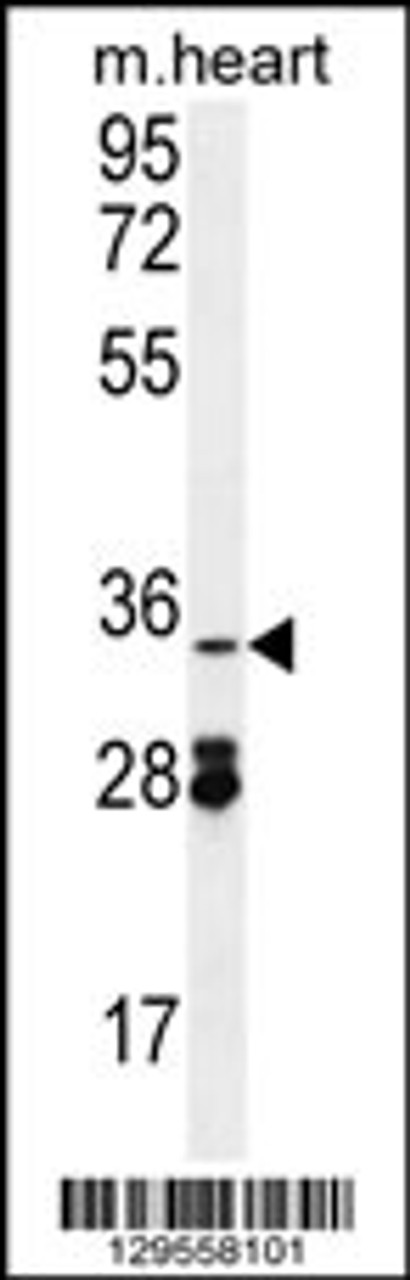 Western blot analysis in mouse heart tissue lysates (35ug/lane) .