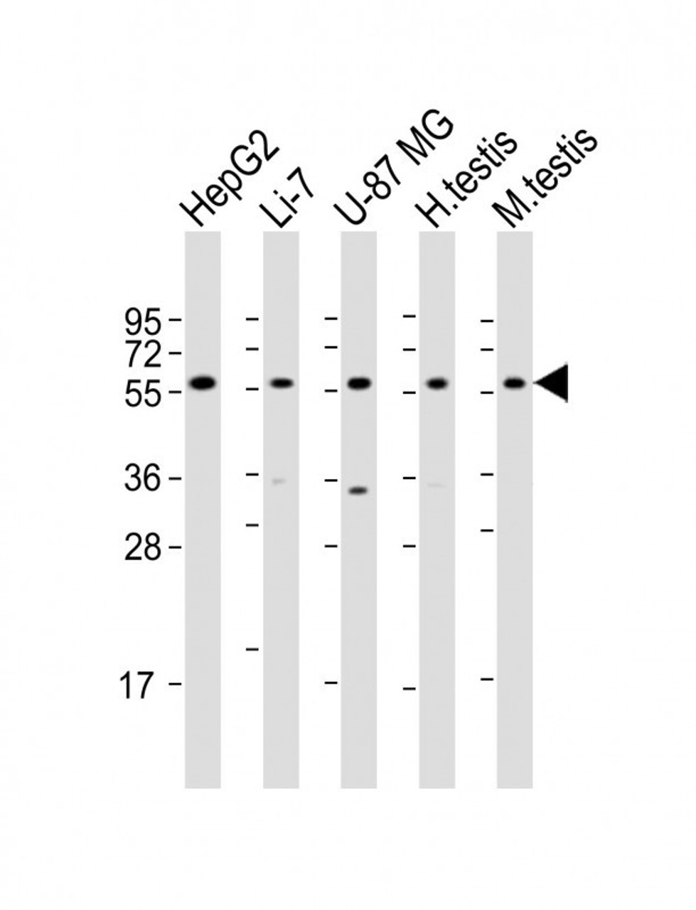 Western Blot at 1:2000 dilution Lane 1: HepG2 whole cell lysate Lane 2: Li-7 whole cell lysate Lane 3: U-87 MG whole cell lysate Lane 4: human testis lysate Lane 5: mouse testis lysate Lysates/proteins at 20 ug per lane.