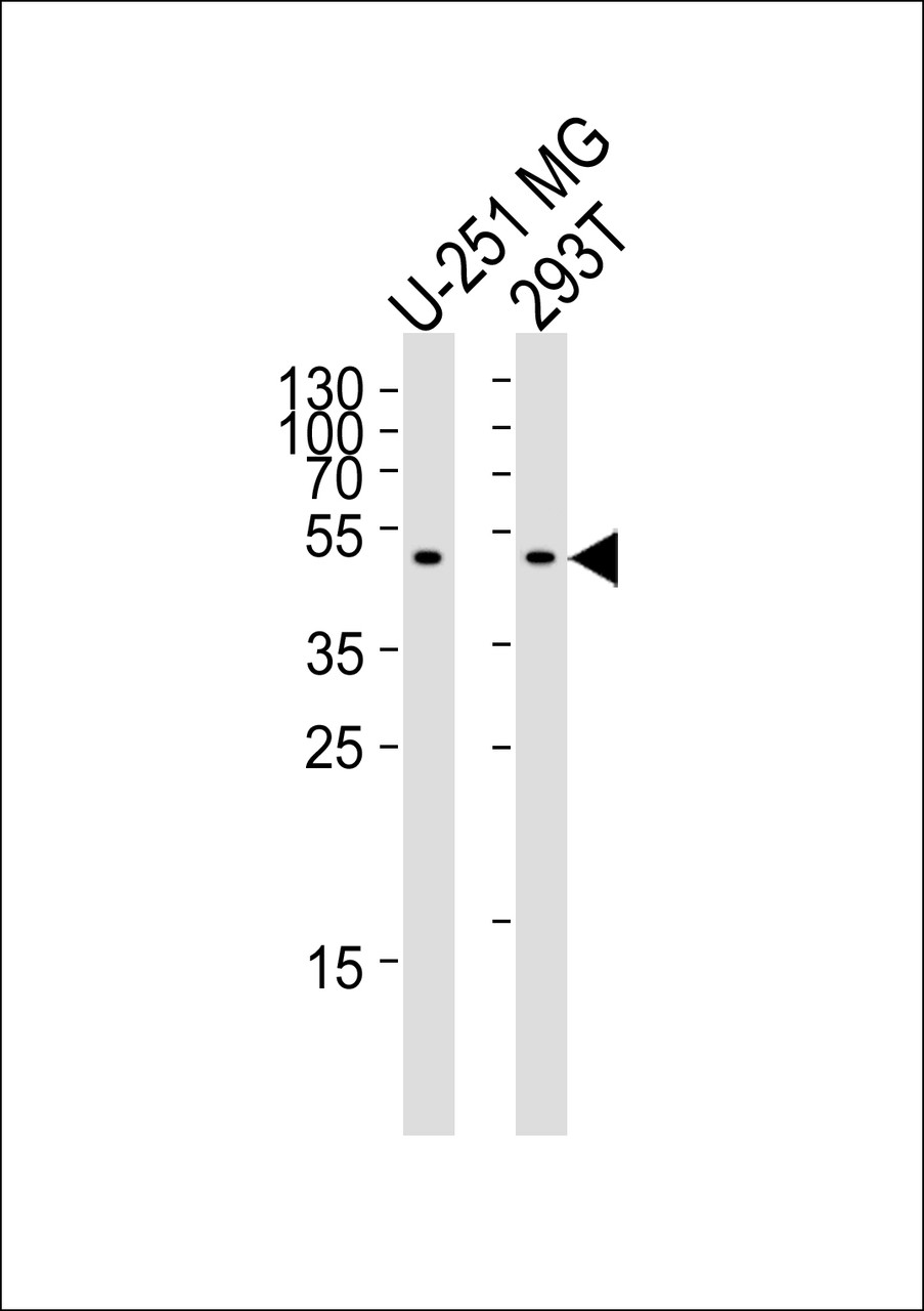 Western blot analysis of lysates from U-251 MG, 293T cell line (from left to right) , using CPM Antibody at 1:1000 at each lane.