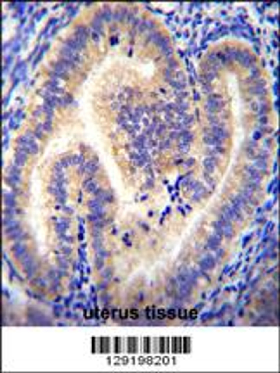 CCDC54 Antibody immunohistochemistry analysis in formalin fixed and paraffin embedded human uterus tissue followed by peroxidase conjugation of the secondary antibody and DAB staining.