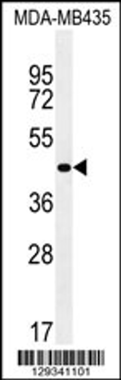 Western blot analysis in MDA-MB435 cell line lysates (35ug/lane) .