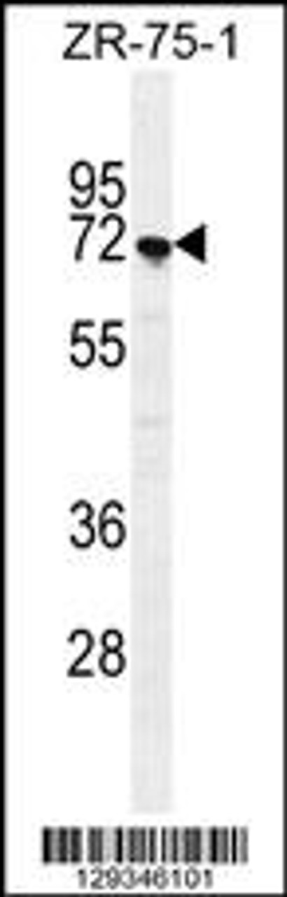 Western blot analysis in ZR-75-1 cell line lysates (35ug/lane) .