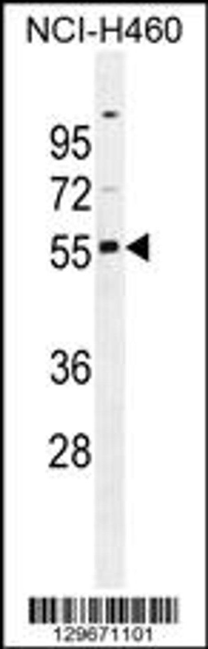 Western blot analysis in NCI-H460 cell line lysates (35ug/lane) .