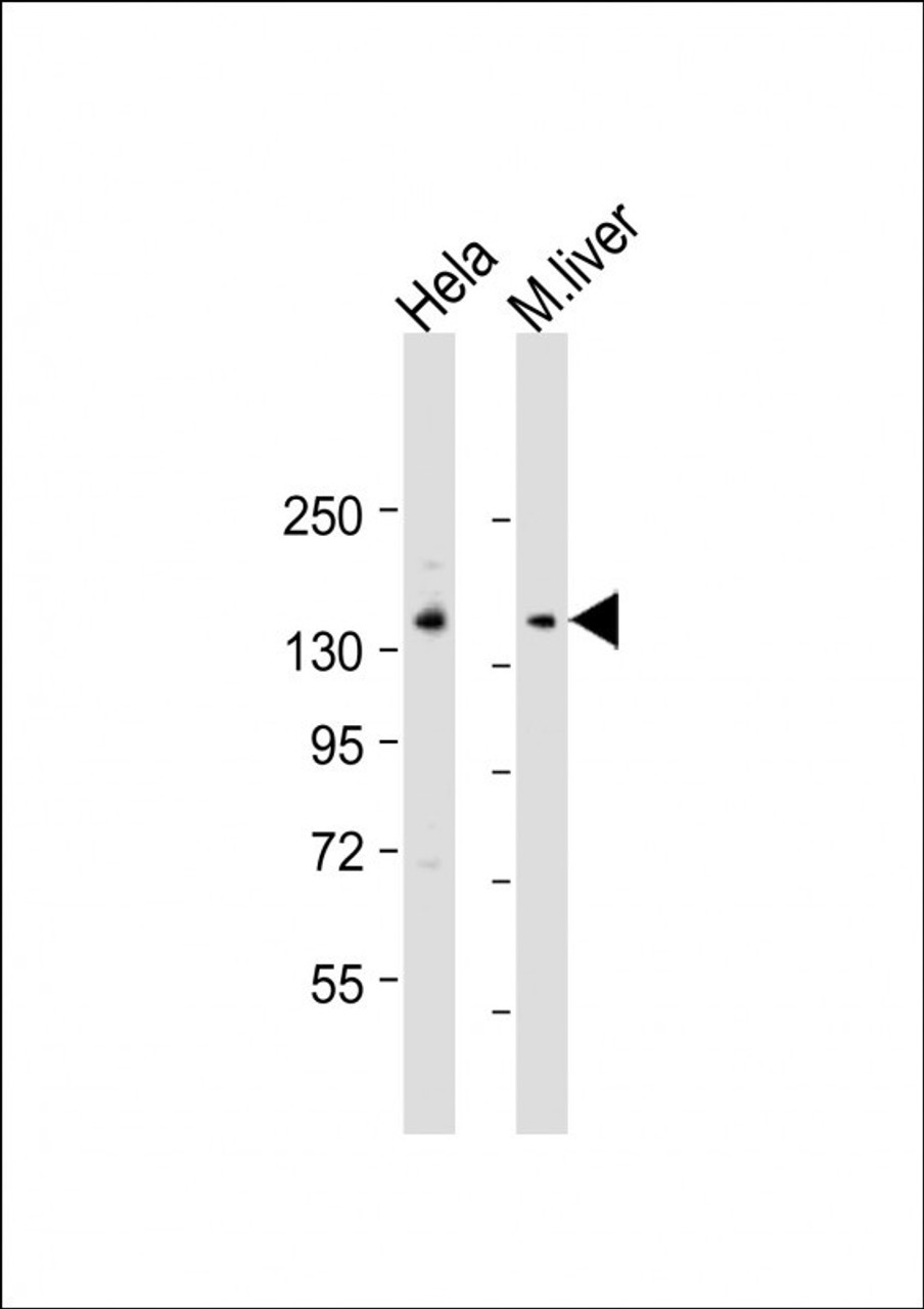Western Blot at 1:1000-1;2000 dilution Lane 1: Hela lysate Lane 2: mouse liver lysate Lysates/proteins at 20 ug per lane.