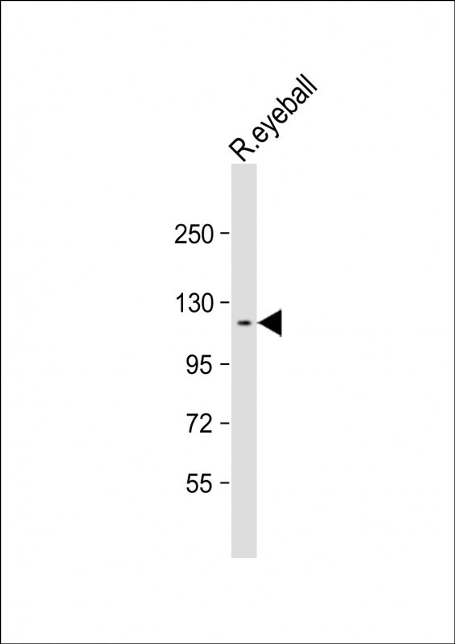Western Blot at 1:2000 dilution + rat eyeball lysate Lysates/proteins at 20 ug per lane.