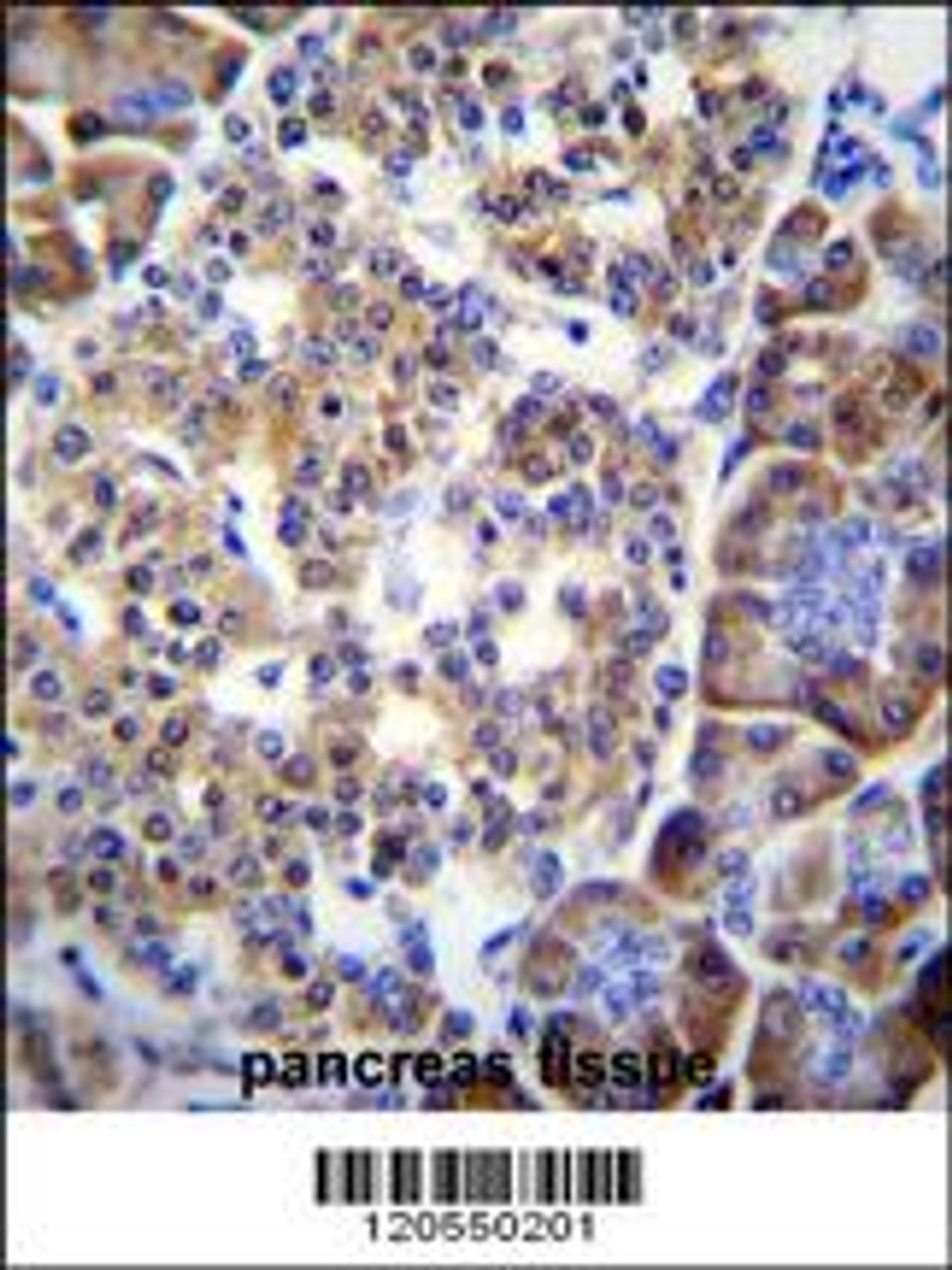 SMYD4 Antibody immunohistochemistry analysis in formalin fixed and paraffin embedded human pancreas tissue followed by peroxidase conjugation of the secondary antibody and DAB staining.