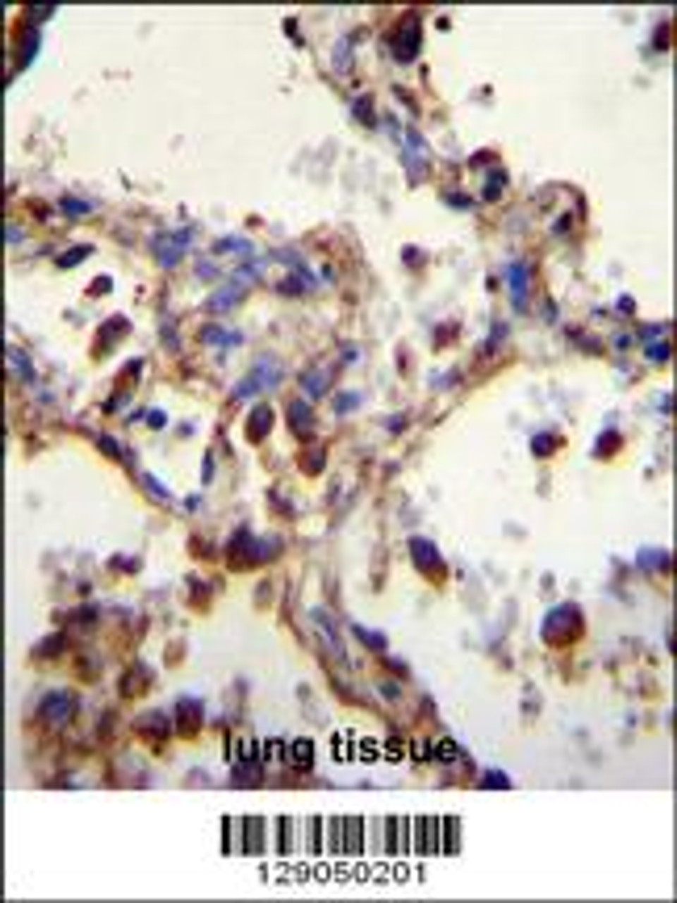 WDR52 Antibody immunohistochemistry analysis in formalin fixed and paraffin embedded human lung tissue followed by peroxidase conjugation of the secondary antibody and DAB staining.