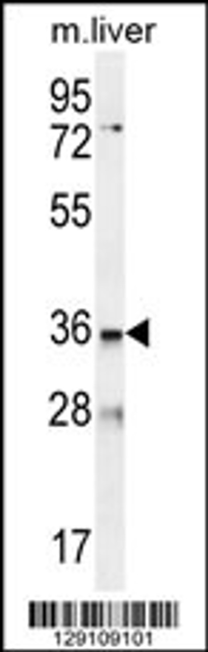 Western blot analysis in mouse liver tissue lysates (35ug/lane) .