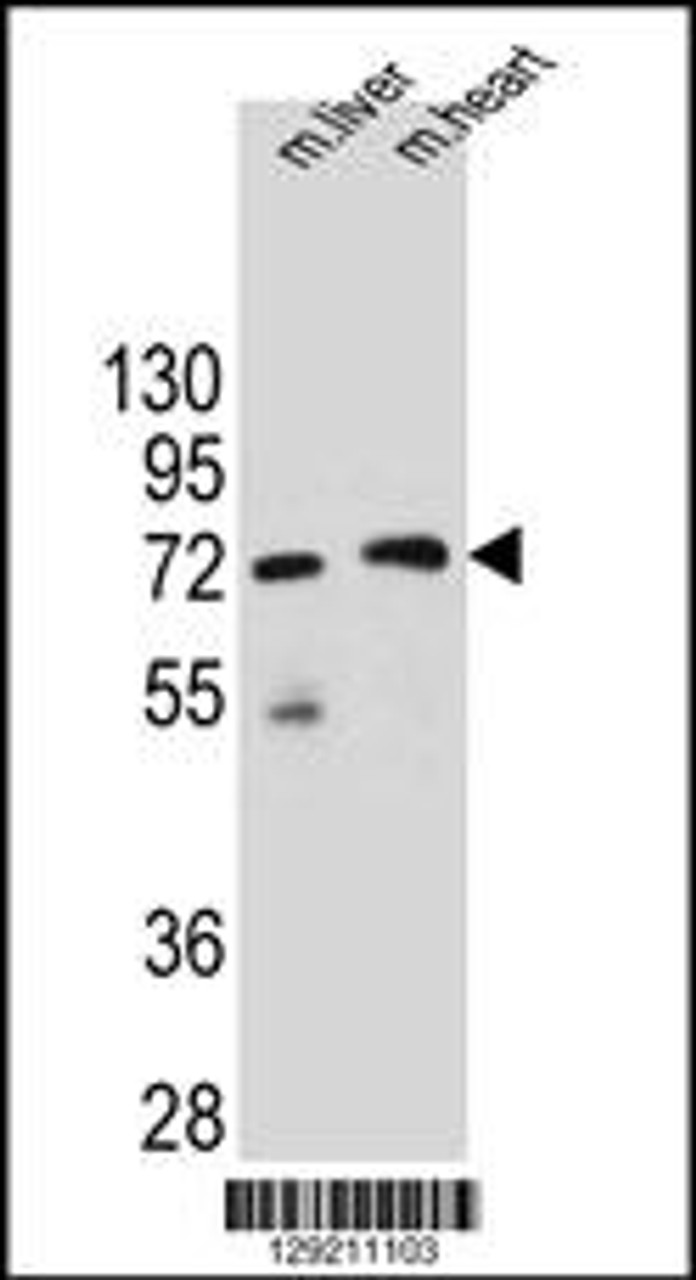 Western blot analysis in mouse liver and heart tissue lysates (35ug/lane) .