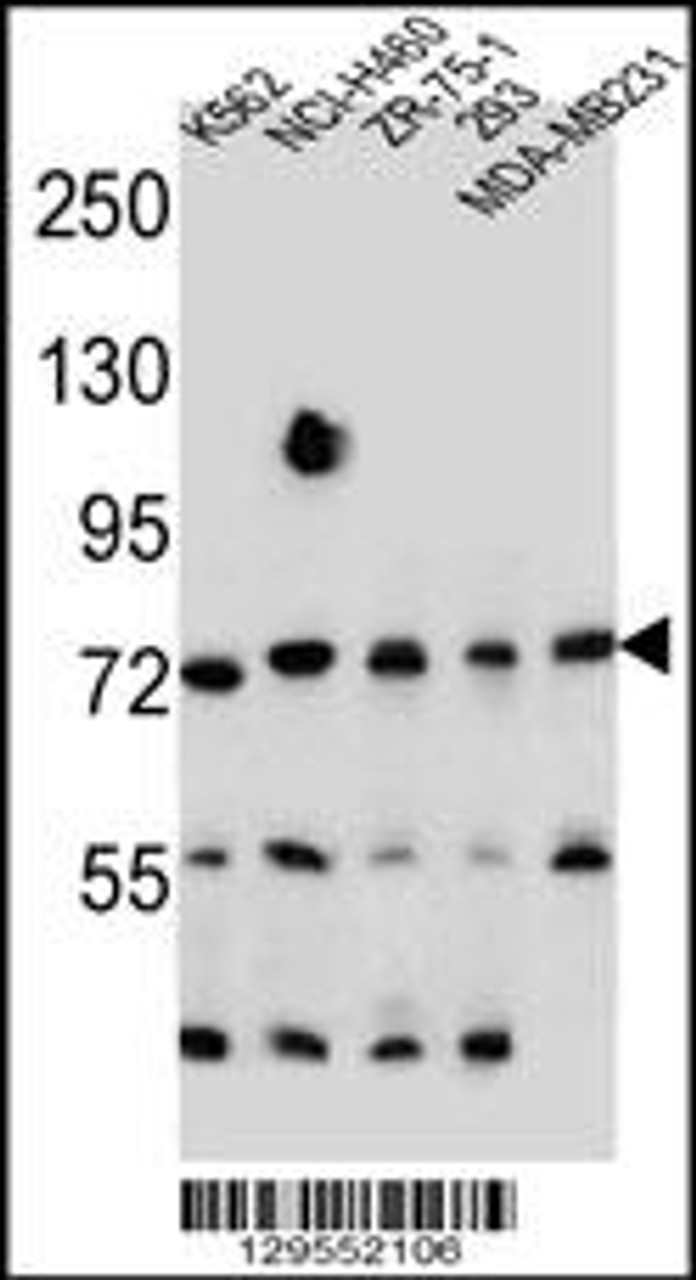 Western blot analysis in K562, NCI-H460, ZR-75-1, 293, MDA-MB231 cell line lysates (35ug/lane) .