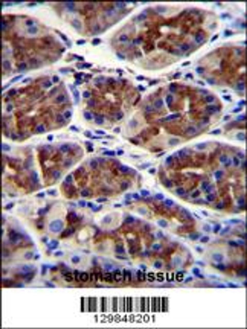 EPHX3 Antibody immunohistochemistry analysis in formalin fixed and paraffin embedded human stomach tissue followed by peroxidase conjugation of the secondary antibody and DAB staining.
