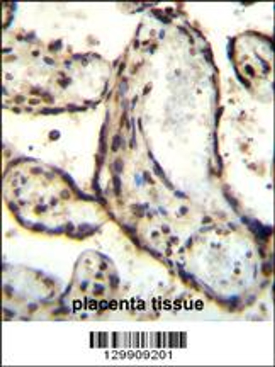 HEXIM1 antibody immunohistochemistry analysis in formalin fixed and paraffin embedded human placenta tissue followed by peroxidase conjugation of the secondary antibody and DAB staining.