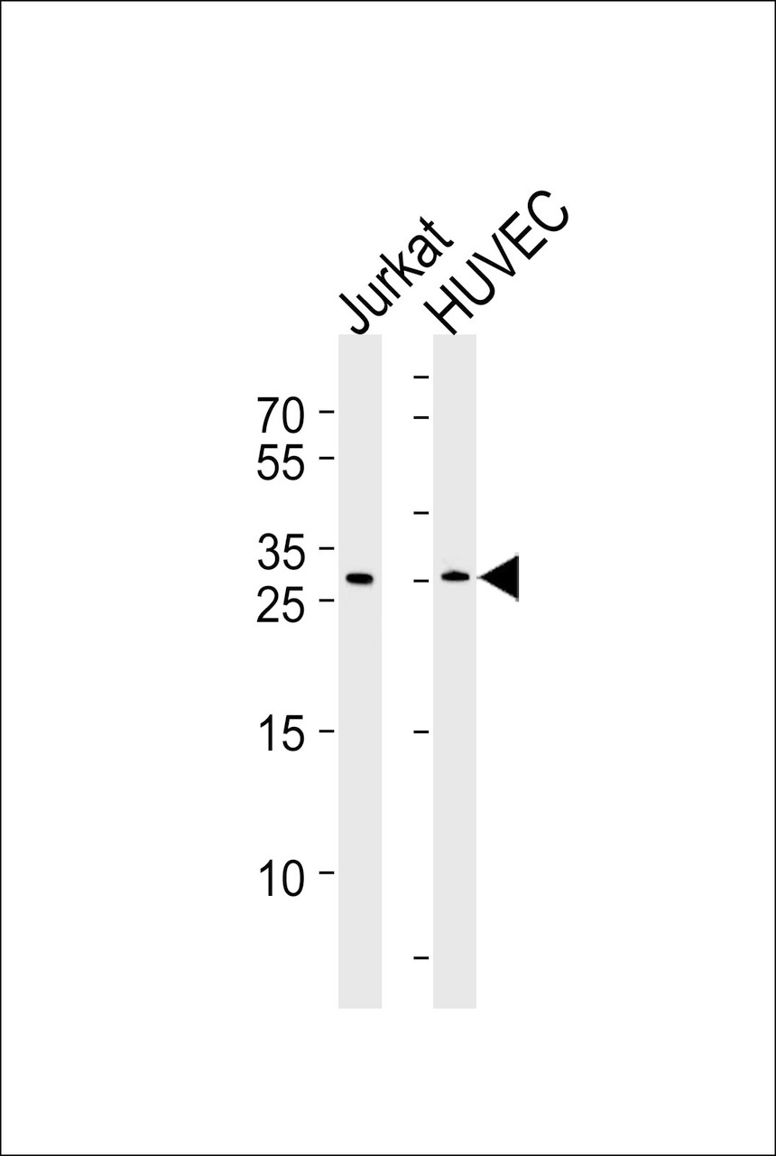 Western blot analysis of lysates from Jurkat, HUVEC cell line (from left to right) , using DKK4 Antibody at 1:1000 at each lane.