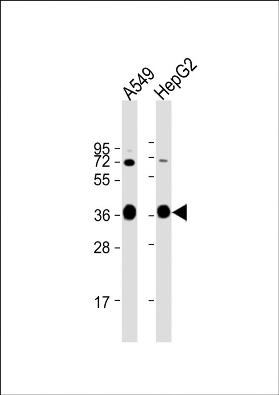 Western Blot at 1:1000 dilution Lane 1: A549 whole cell lysate Lane 2: HepG2 whole cell lysate Lysates/proteins at 20 ug per lane.