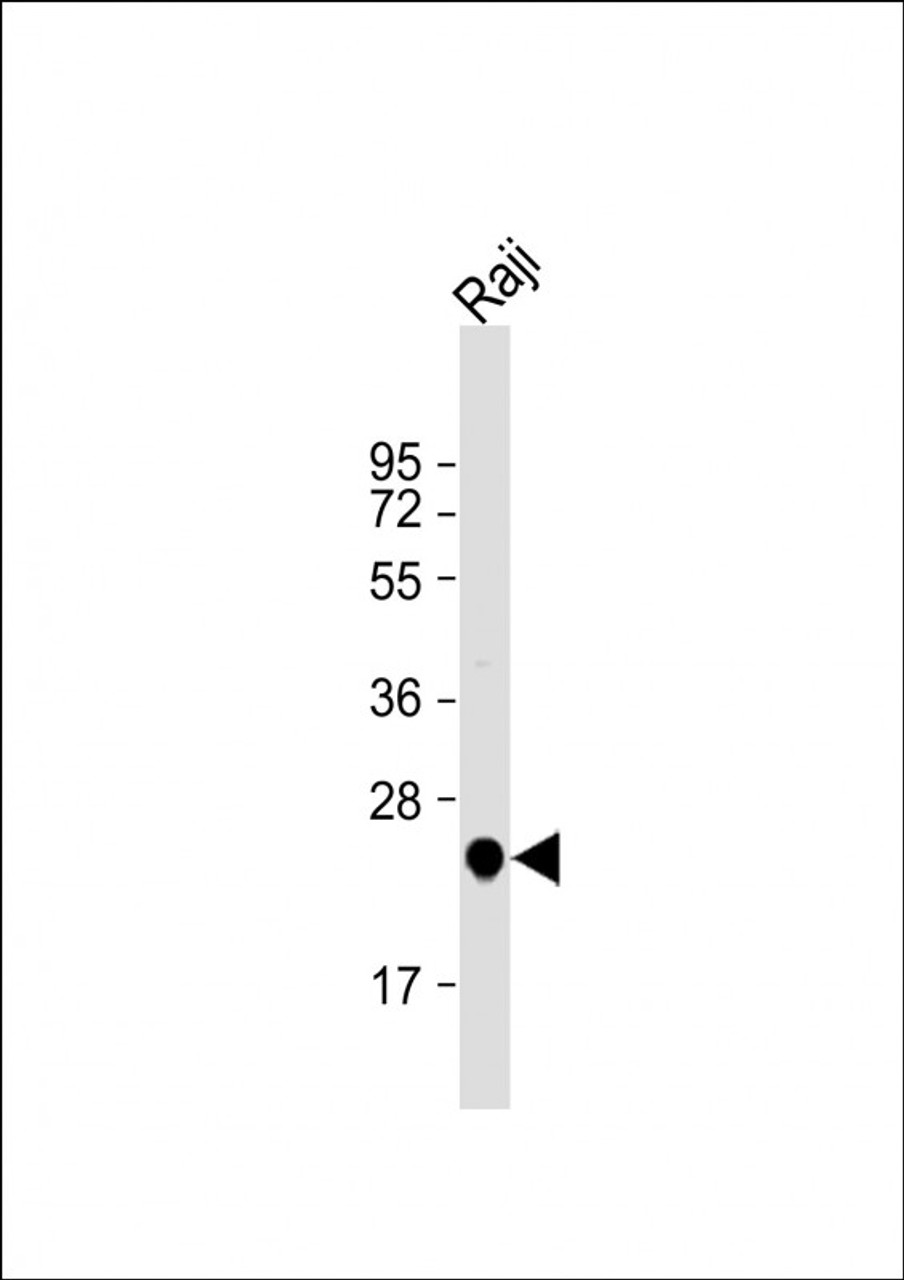 Western Blot at 1:1000 dilution + Raji whole cell lysate Lysates/proteins at 20 ug per lane.