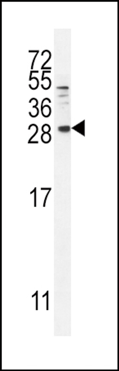 Western blot analysis in MDA-MB231 cell line lysates (35ug/lane) .