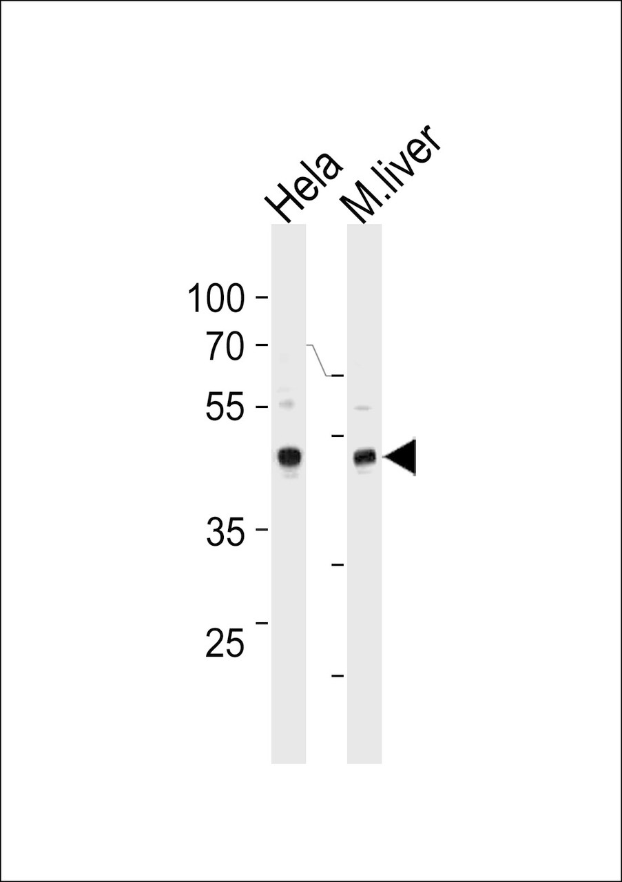 Western blot analysis in Hela cell line and mouse liver tissue lysates (35ug/lane) .This demonstrates the TBX6 antibody detected the TBX6 protein (arrow) .