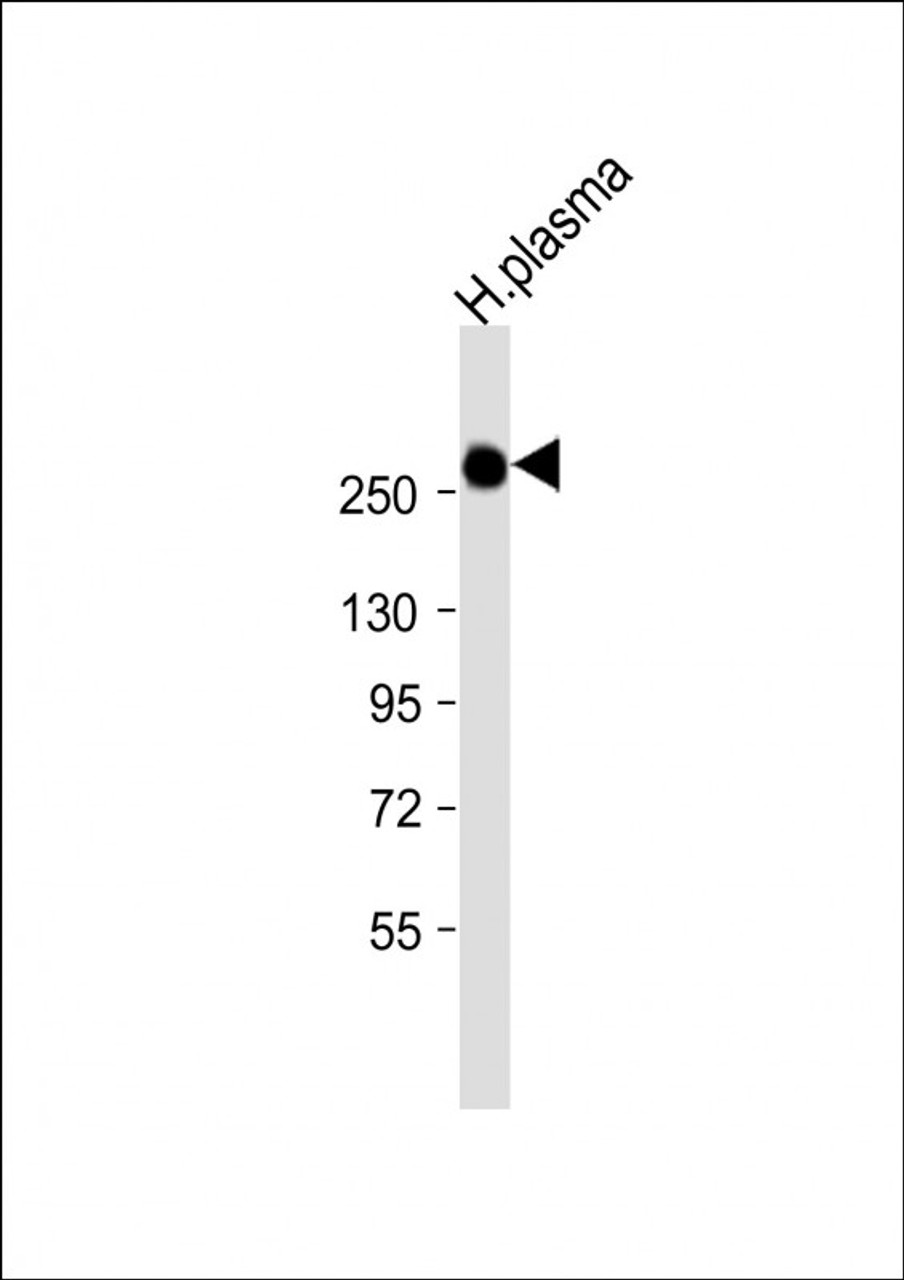 Western Blot at 1:1000 dilution + human plasma lysate Lysates/proteins at 20 ug per lane.