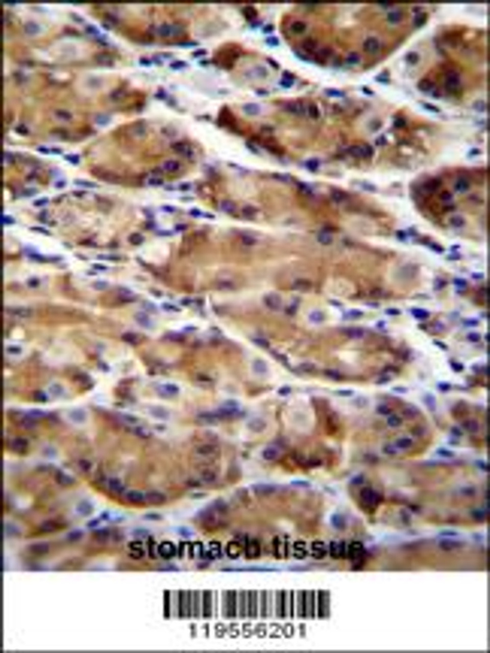 AT immunohistochemistry analysis in formalin fixed and paraffin embedded human stomach tissue followed by peroxidase conjugation of the secondary antibody and DAB staining.This data demonstrates the use of AT for immunohistochemistry.