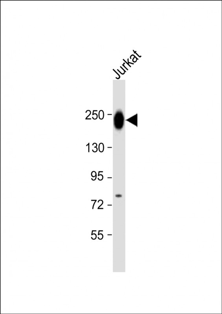 Western Blot at 1:1000 dilution + Jurkat whole cell lysate Lysates/proteins at 20 ug per lane.