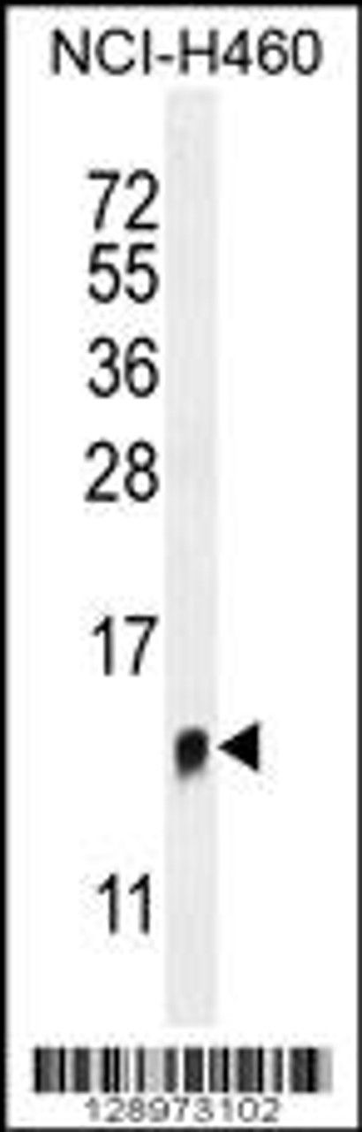 Western blot analysis in NCI-H460 cell line lysates (35ug/lane) .