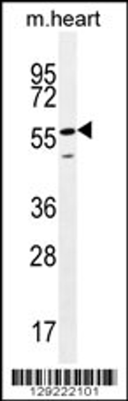 Western blot analysis in mouse heart tissue lysates (35ug/lane) .