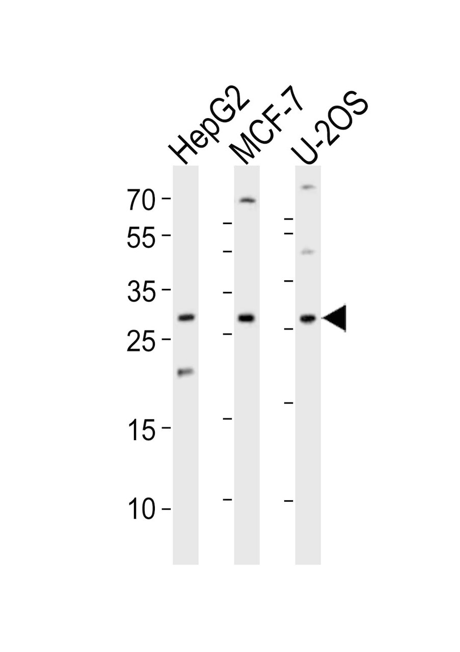 Western blot analysis of lysates from HepG2, MCF-7, U-2OS cell line (from left to right) , using ID1 Antibody at 1:1000 at each lane.