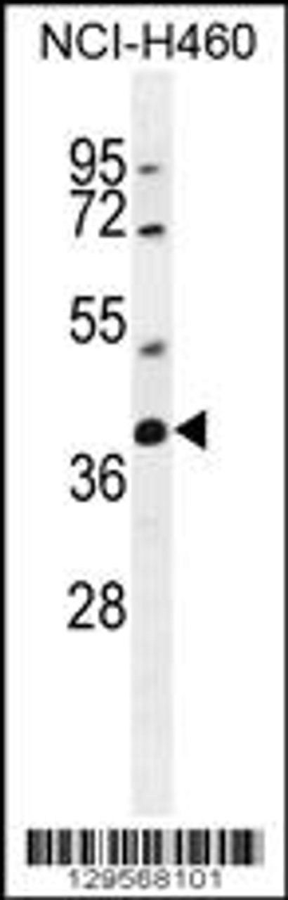 Western blot analysis in NCI-H460 cell line lysates (35ug/lane) .