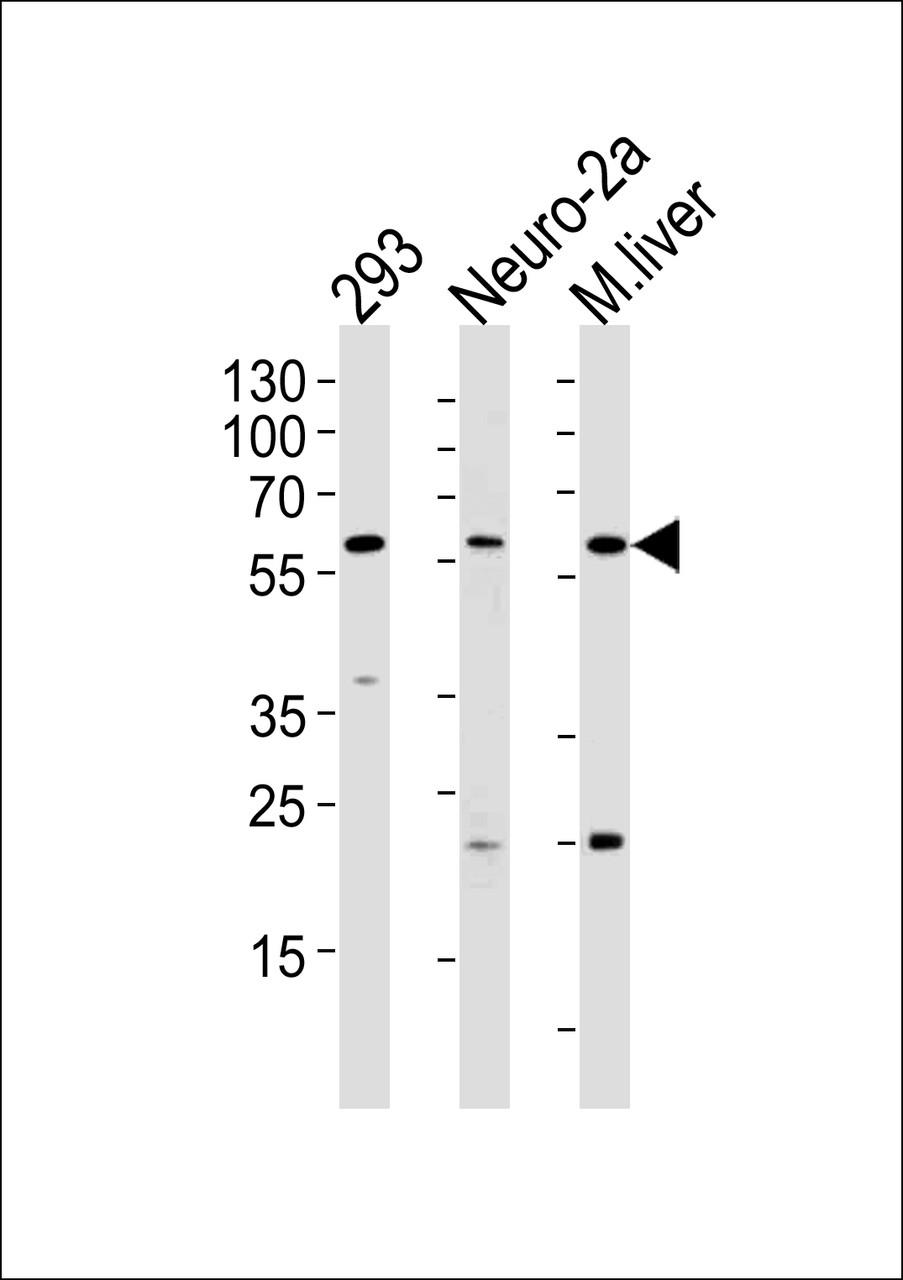 Western blot analysis of lysates from 293, Neuro-2a cell line and mouse liver tissue (from left to right) , using CCDC36 Antibody at 1:1000 at each lane.