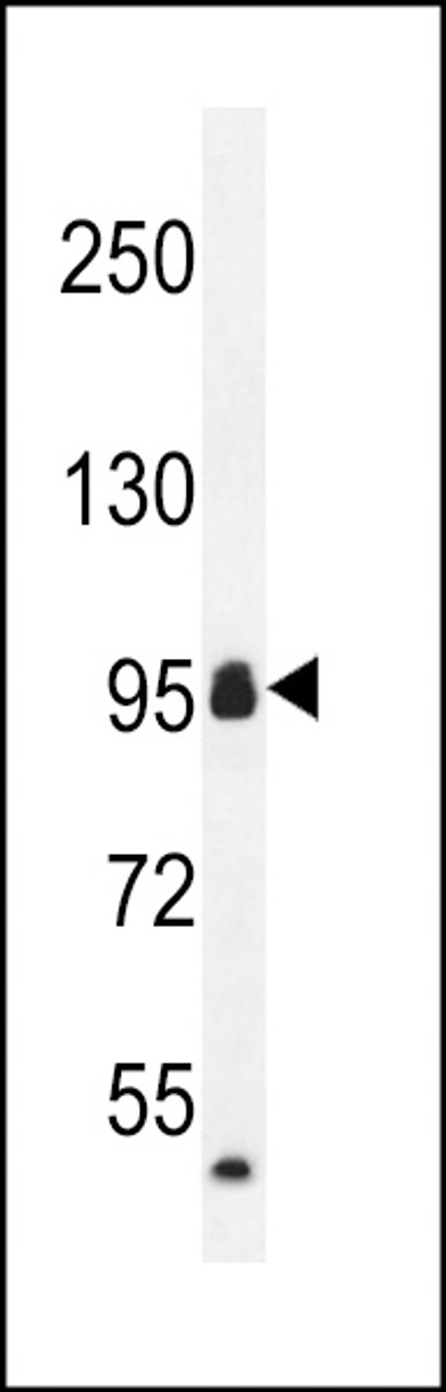 Western blot analysis in mouse heart tissue lysates (35ug/lane) .