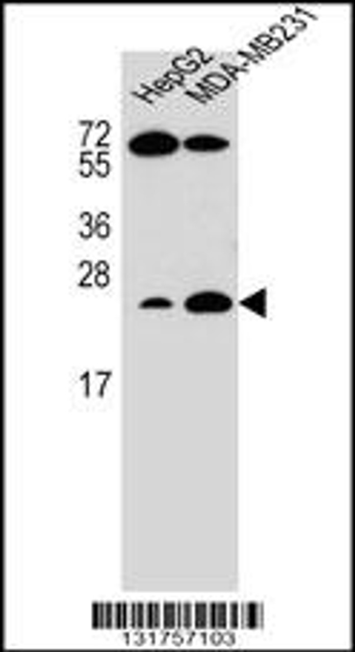 Western blot analysis in HepG2, MDA-MB231 cell line lysates (35ug/lane) .