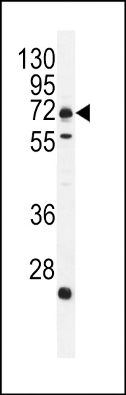 Western blot analysis in MDA-MB231 cell line lysates (35ug/lane) .