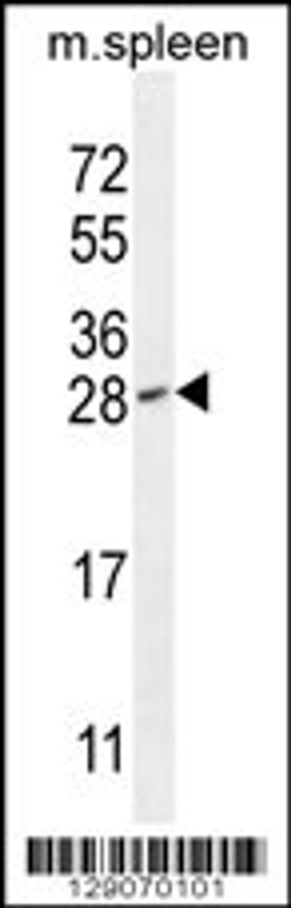 Western blot analysis in mouse spleen tissue lysates (35ug/lane) .